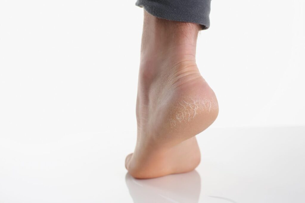 エクササイズ
カーフレイズ