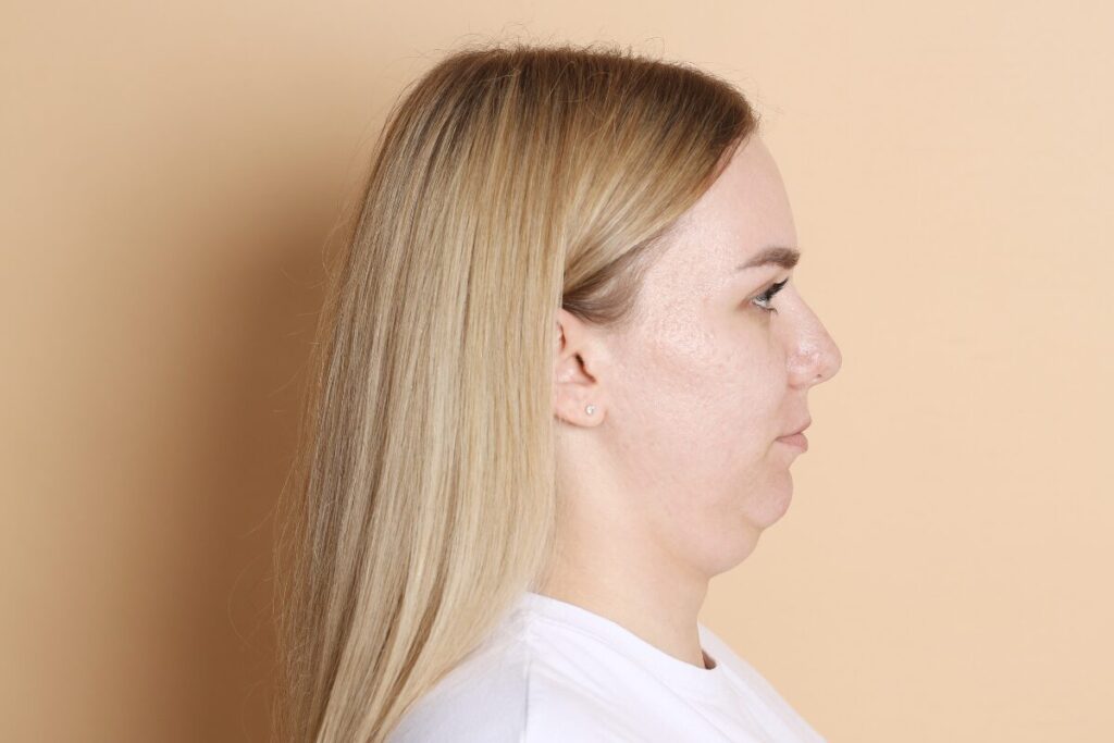 ちょっと幅取り過ぎじゃない？心のデブとは？
デブという言葉
二重アゴの女性