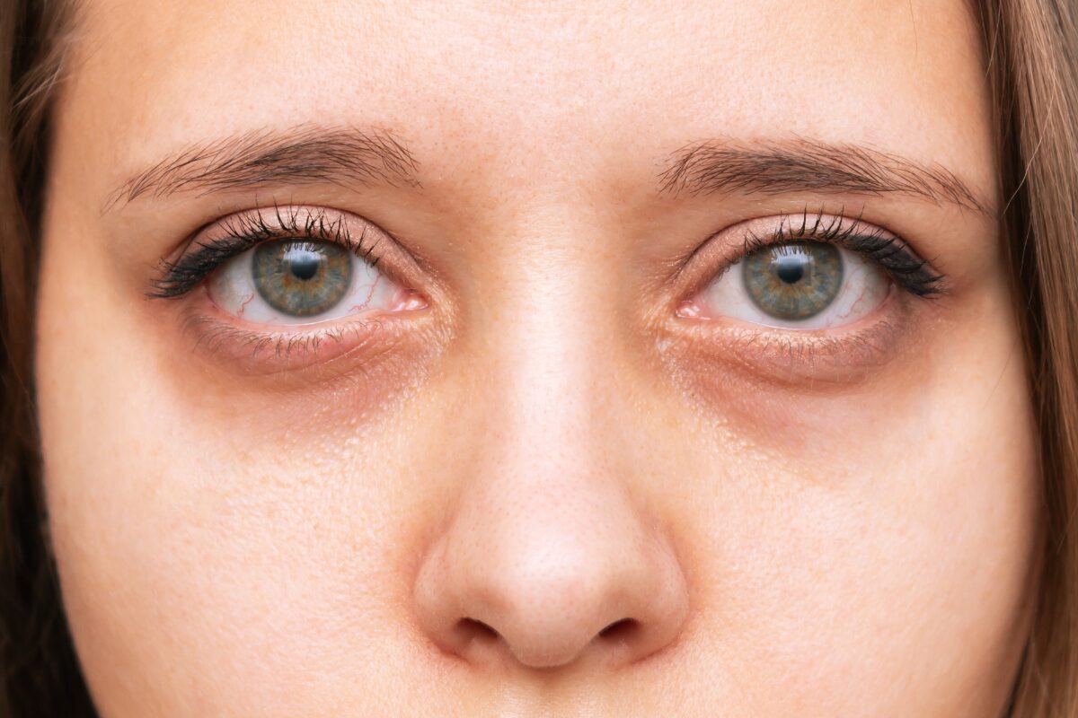 寝不足のあなたに起きること 忙しい毎日なのに、ついつい夜更かして推しの配信を見ながらいつ眠りについたかも分からぬまま寝落ちするあなた。人間って8時間は寝ないといけないんじゃなかったけ？いやショートスリーパーもいるくらいしな。などと眠い目をこすりながら翌日も仕事へ。 これ、絶対体に良いわけありません！今回は寝不足が続くとどうなっちゃうのかというコワいお話しです。