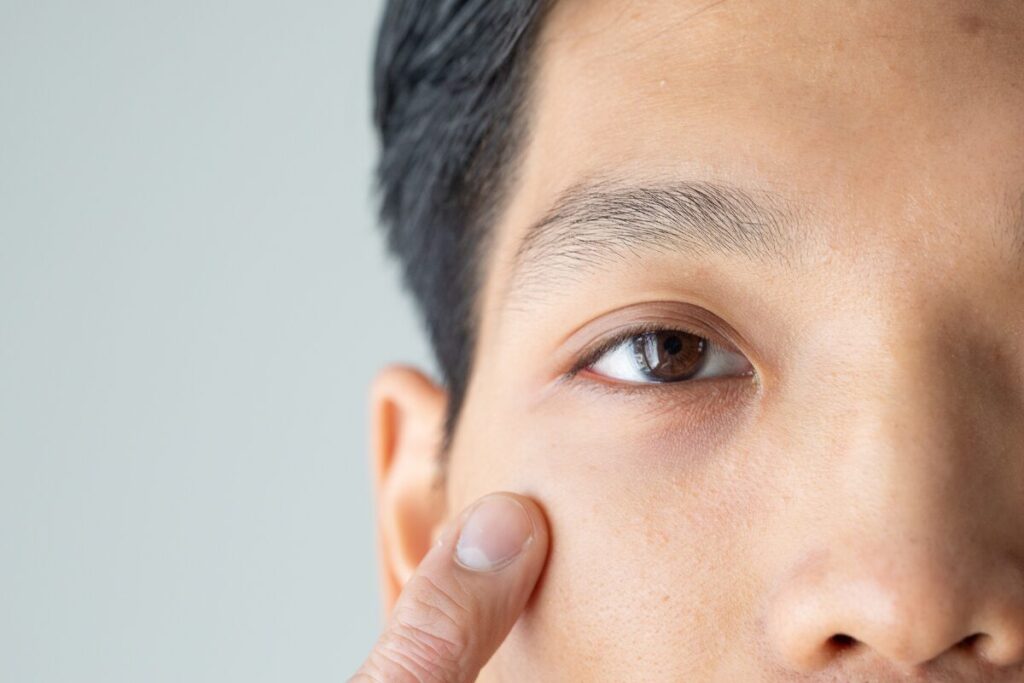 寝不足のあなたに起きること
ショートスリーパーなんていない
目の下にクマの男性